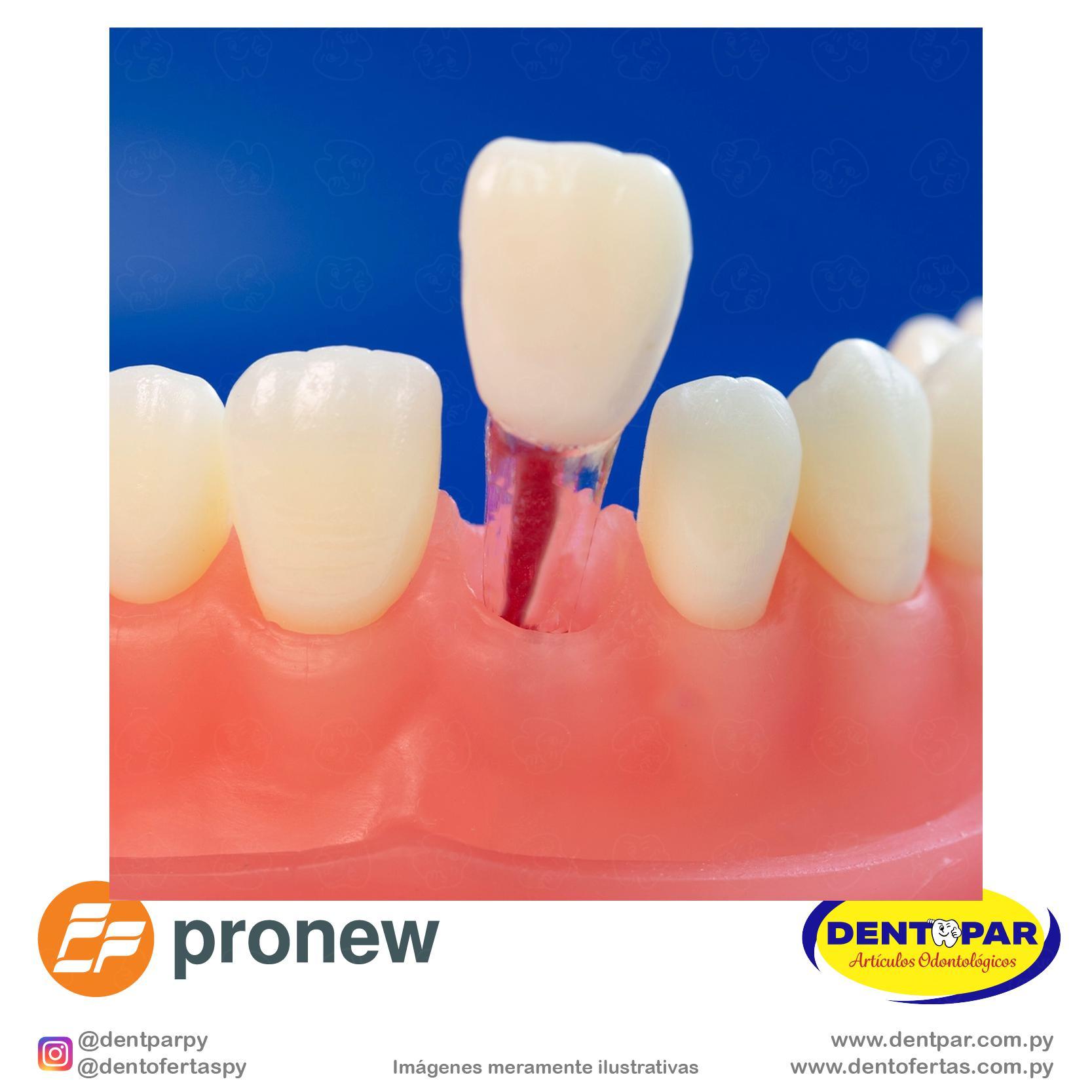 Imagen del producto Diente con Canal Endo Transparente #11